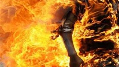 باكستانية تحرق ابنتها لزواجها دون موافقتها
