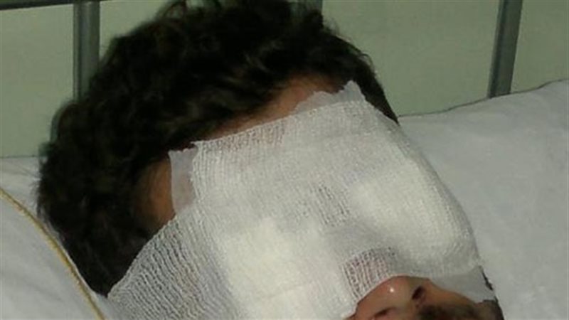 طالب يفقد عينه