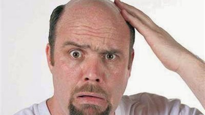 وصفة لعلاج الصلع بالثوم والأعشاب