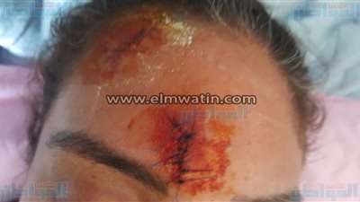 بالصور.. بلاغ ضد طليق أنغام بتهمة التعدي بالضرب على سيدة وإصابتها