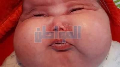 بالصور.. طبيب أطفال يطالب وزير الصحة بحملات لتوعية الأمهات