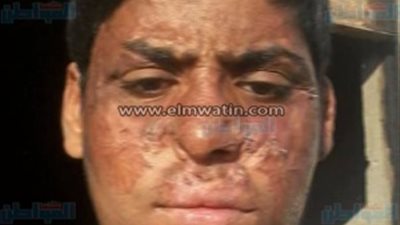 استغاثة عاجلة من مواطن بالفيوم إلى وزير الصحة