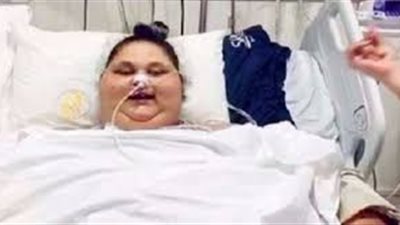 أسمن امرأة بالعالم تعاني من مشاكل صحية قد تبقيها عامًا للشفاء بالإمارات