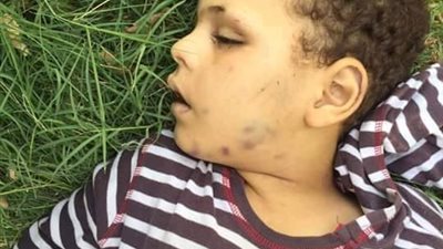 صورة.. العثور على جثة طفل مُعذب أسفل شجرة في مصر القديمة