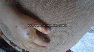 بالصور.. 