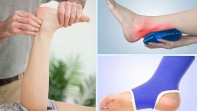 3 طرق بسيطة لعلاج الكدمات في البيت