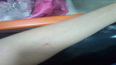 صور| طفل البحيرة يحاول الانتحار تنفيذا لأوامر 