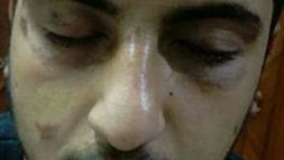 صور| أمن طنطا  يعتدي على طالب تجارة بـ