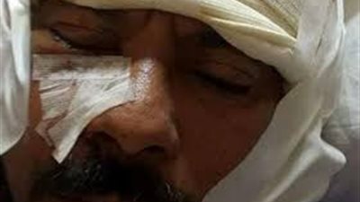 التعدي على مدير تطوير حديقة روكسي بـ