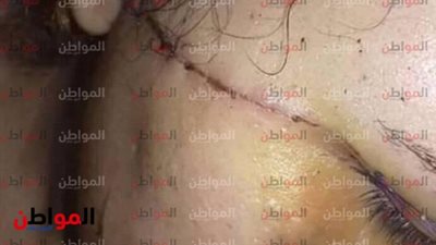 تجرد من مشاعر الرحمة .. 