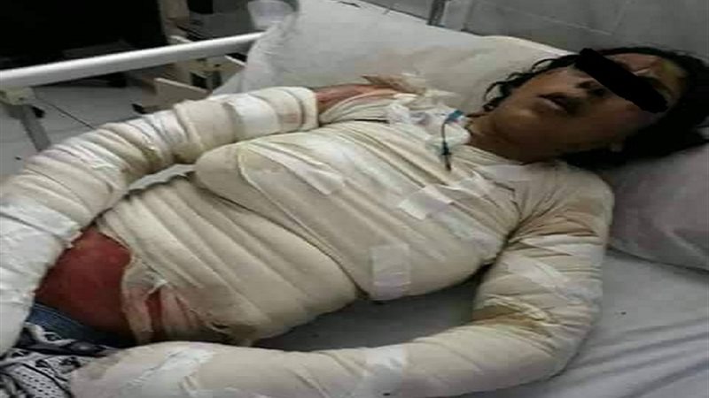 صورة المريضة 
