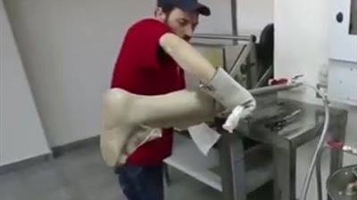 الحرب تطور صناعة الأطراف فى سوريا 
