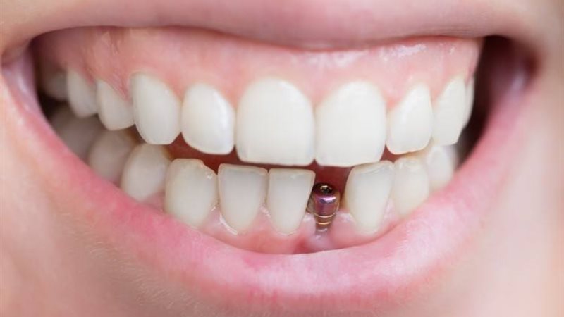طب الأسنان الحديثة