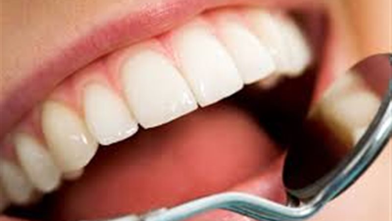 علاج تسوّس الأسنان