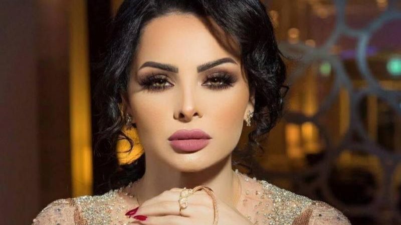 الفنانة ديانا كرزون