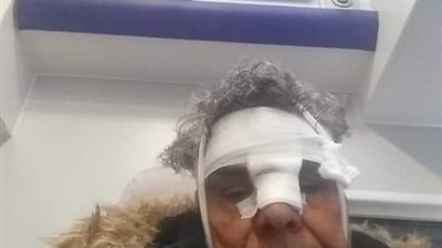 صور.. جماعة الإخوان تعتدى على رئيس الجالية المصرية فى ألمانيا أثناء زيارة الرئيس السيسى 