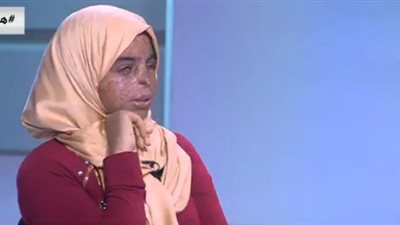 فيديو.. جولفدان محمود: سرطان الجلد منعنى أكمل تعليمى ويكون عندى أصحاب 