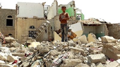 الوضع الإنساني في اليمن .. أشباح الموت جوعًا تطوق مملكة بلقيس السعيدة