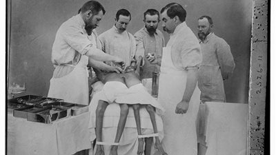 حكاية صورة..أقدم عملية جراحية منذ 100 سنة لفصل توأم