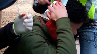 بوابة المواطن تنفرد بنشر صور وحصيلة إصابات السترات الصفراء في الأسبوع العاشر