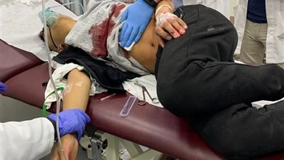 إصابة شاب بجراح خطيرة برصاص المستعربين 