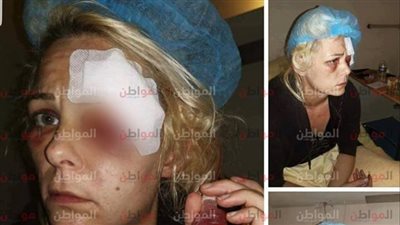 صور صادمة .. فرنسا ترفع شعار حقوق الإنسان والسترات الصفراء تكشف الستار عن الوجه القبيح لباريس