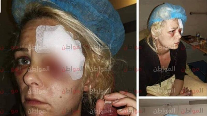 ضحايا عنف الشرطة