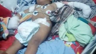 صعق كهربي.. وبتر ذراع طفل.. تفاصيل واقعة إهمال موظف كفر الشيخ