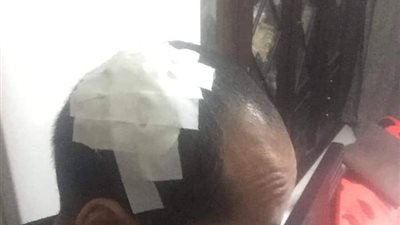 طبيب يعلِّم ممرضًا كيفية خياطة الجروح في مستشفىً عام