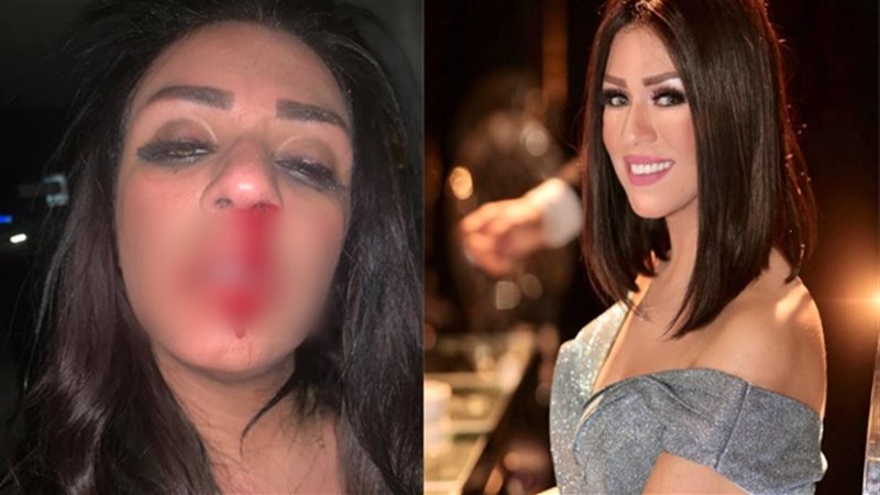 شاهيناز ضياء