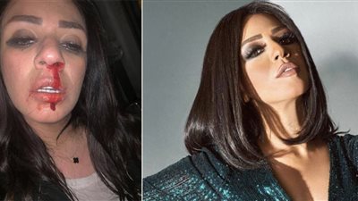 إنفراد| «بالتسجيل الصوتي» شاهيناز ضياء تقاضي طليقها 