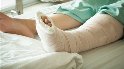 فيديو| جه يكحلها عماها .. رجل يكسر قدم امرأة بسبب مساج 