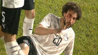 إصابة محمود علاء تضع الزمالك في ورطة قبل القمة 117