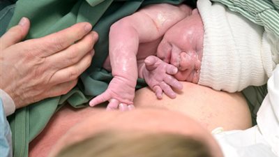 أول روبوت آلي بدرجة طبيب نساء