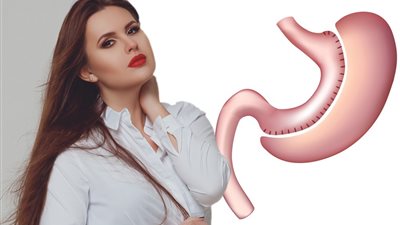 «عملية التكميم الميني » أحدث طفرة في جراحات السمنة