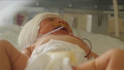 بالصور.. استئصال جنين من بطن رضيعة عمرها 7 أيام في أسيوط