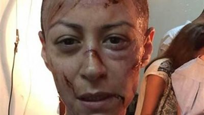 سر صورة منة شلبي التي أشعلت مواقع التواصل الاجتماعي