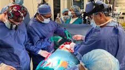 فشل أول عملية زراعة رئة.. وجامعة عين شمس تعلن التفاصيل بعد قليل