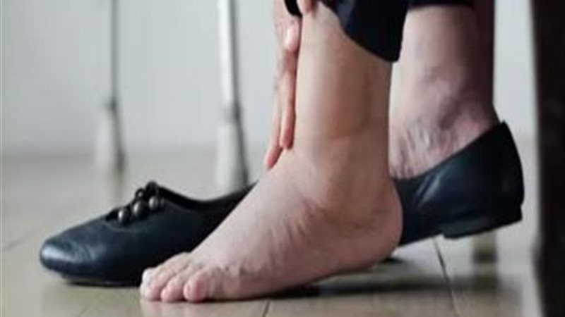 الحذاء المناسب لمرضى