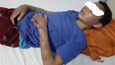 بسبب فقده مبلغ مالى.. أب ينهال ضربًا على ابنه بعصا خشبية بالمرج 