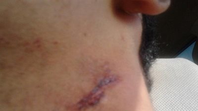 الطب الشرعي: «شريك السعودي» توفي بسبب جرح قطعي بالرقبة