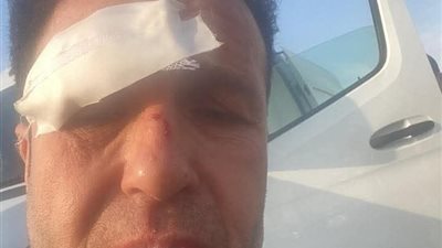 صور .. إصابة الإعلامي حسن الشاذلي إثر تعرضه لحادث