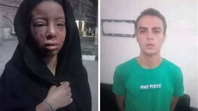 وجه مشوه وعيون مفقوعة: طفلة بلبيس ضحية الذئب البشري تثير غضب الشارع 
