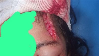 ظاهرة الكلاب الضالة بين الخطر الصحي والمسؤولية المجتمعية