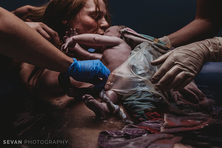 الصور الفائزة بمسابقة الرابطة الدولية لمصوري الولادة المحترفين  لعام 2019