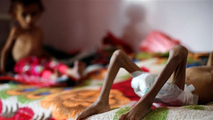 اليمن والمجاعة